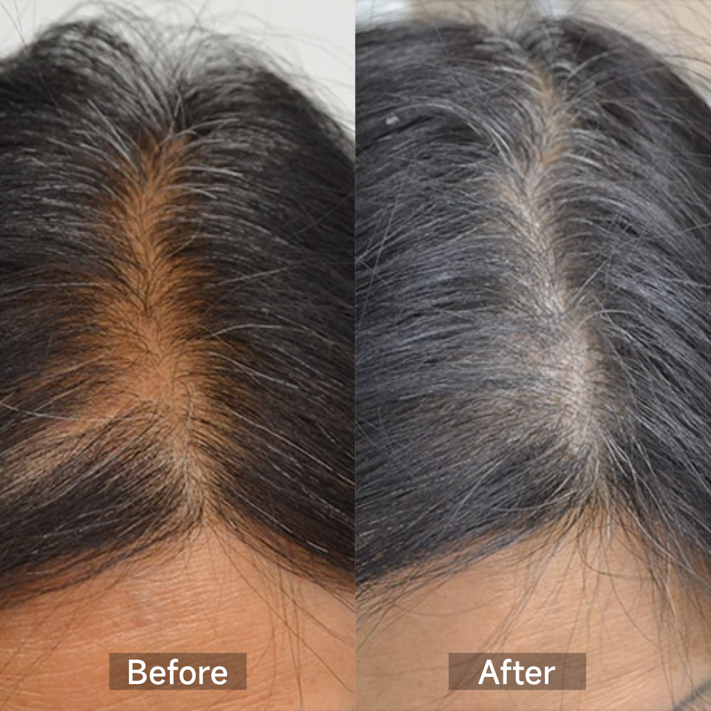 Megelin GrowLux Laser+LED Cap