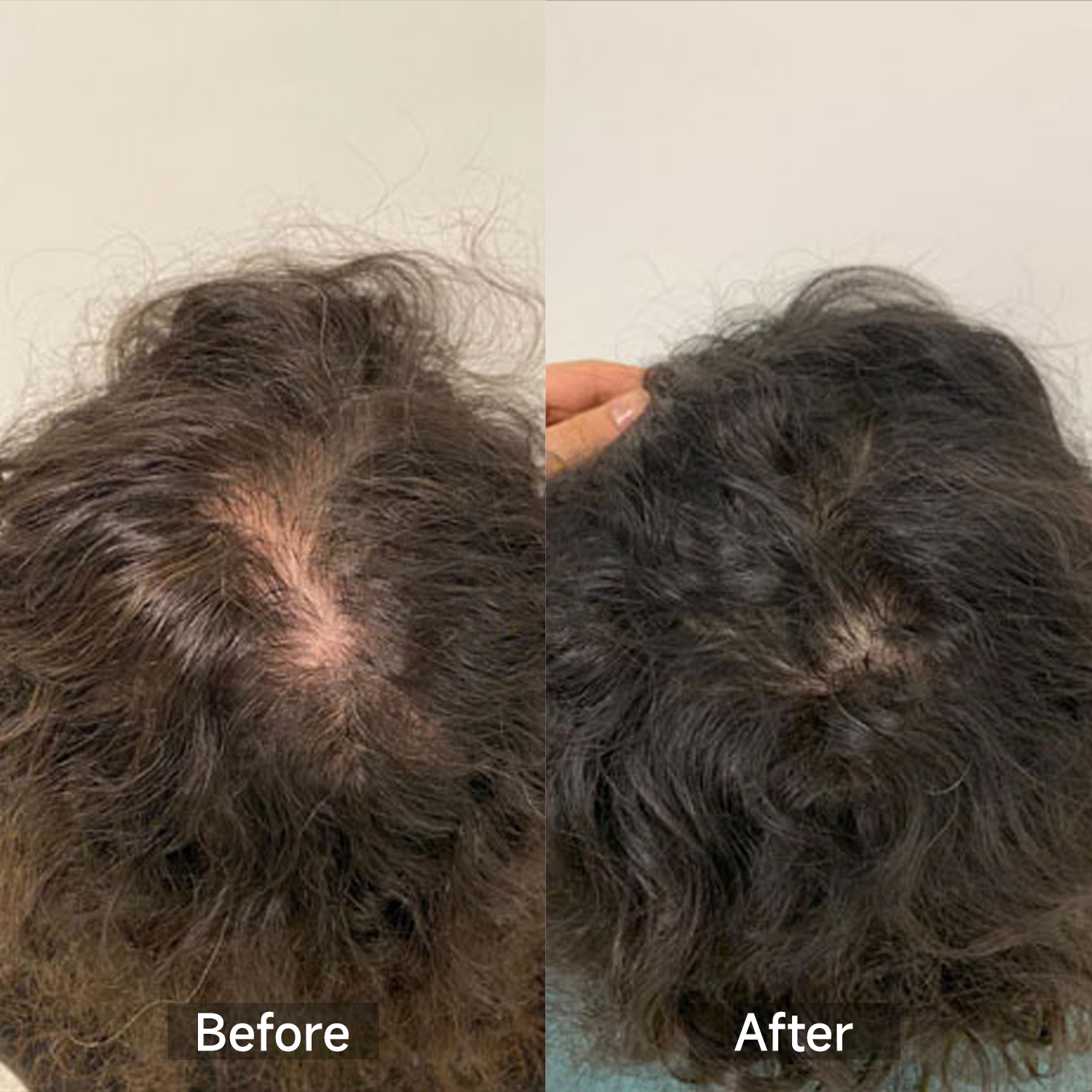 GrowLux Laser+LED Cap