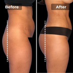 Megelin EMS Toning Shorts