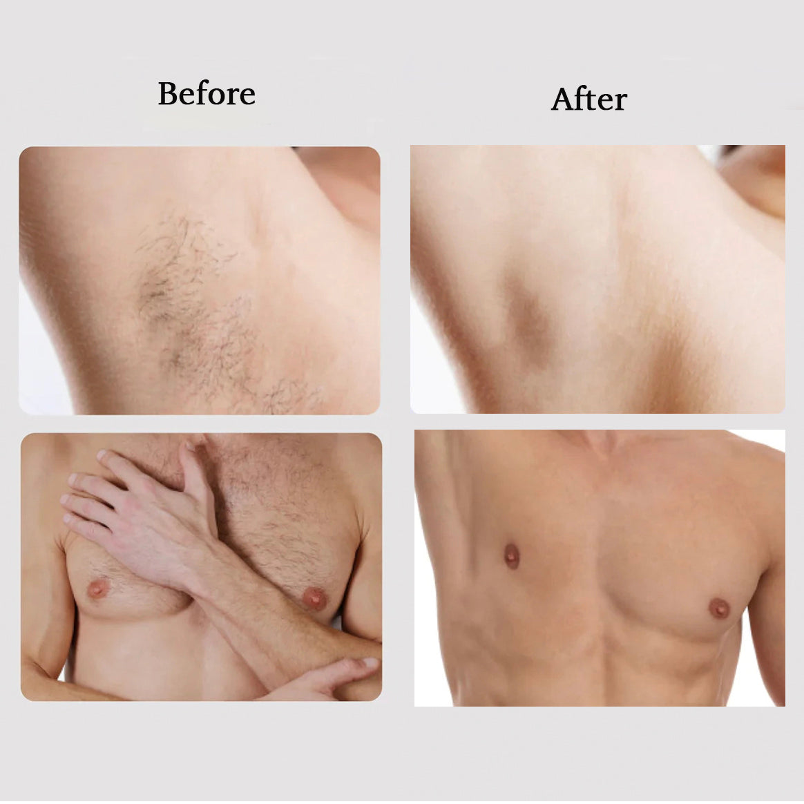 Free M1 IPL Hair Removal